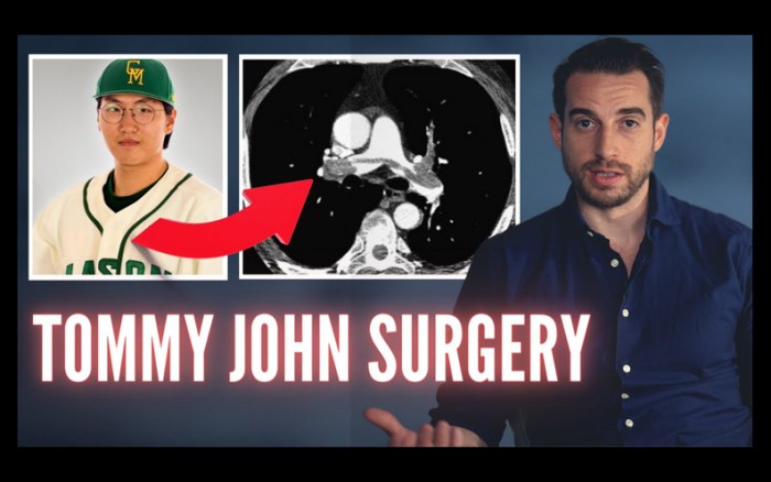 Pitcher Dies After Tommy John Surgery - Doctor Explains Guardians rhp ben lively undergoes tommy john surgery