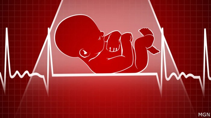 Study Finds 16% Increased Infant Mortality in States That Restrict ... Infant mortality births increased states abortion bans studies